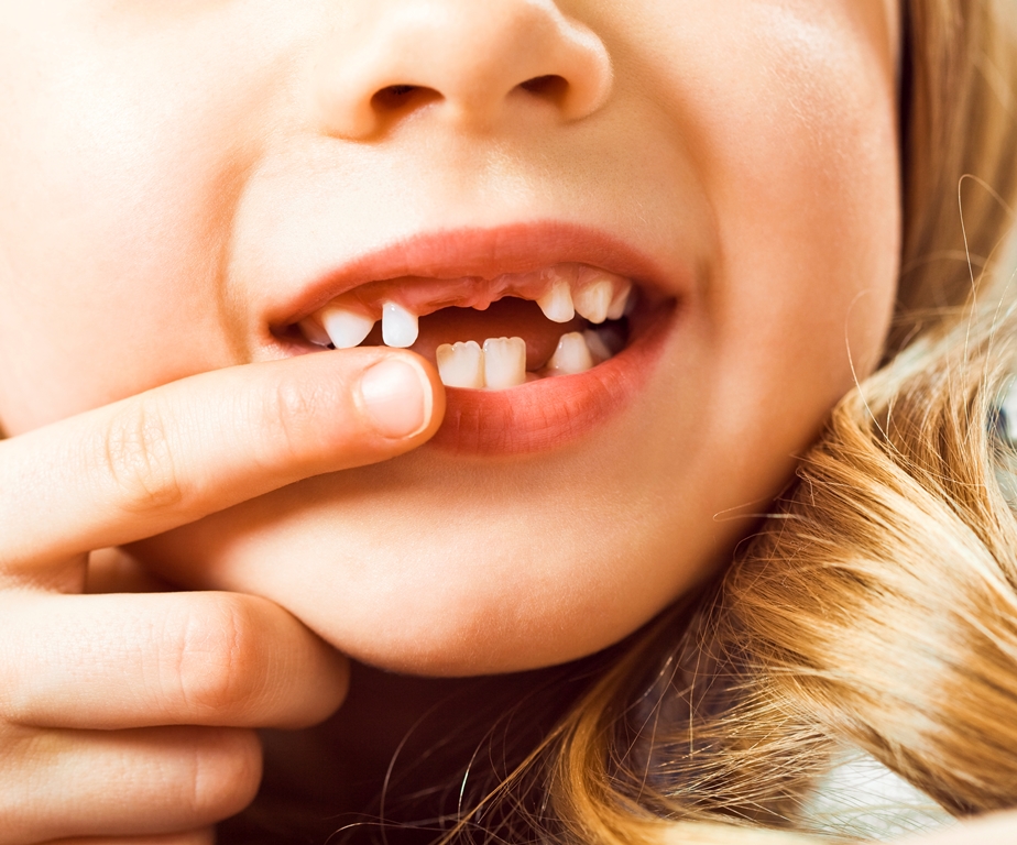 5 Common Dental Problems in Children