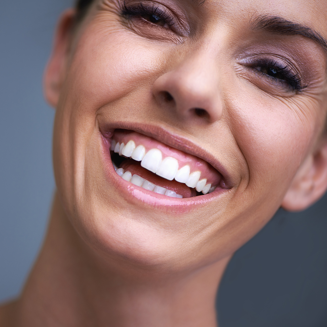 Who is the ideal patient for teeth whitening?