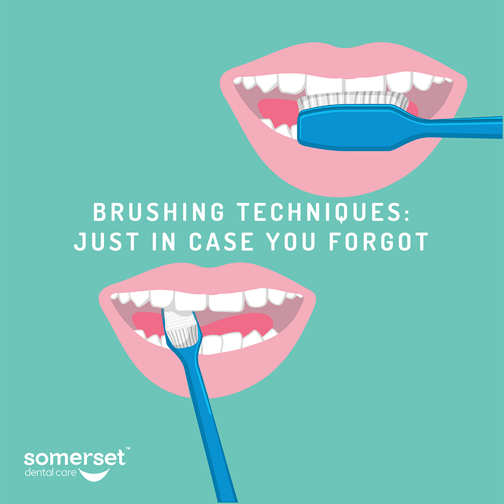 Brushing techniques: just in case you forgot