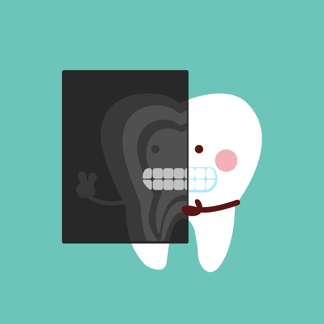 dental radiographs cartoon